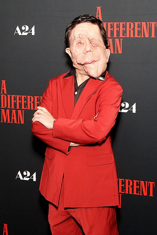 adam-pearson-5715734