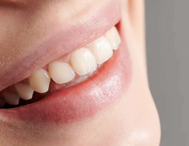 Что такое протезирование зубов