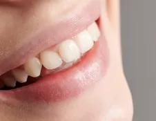 Что такое протезирование зубов и как проходит восстановление зубного ряда